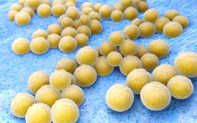 Stafilokoke napadaju: Staphylococcus aureus bakterija može biti opasna po vas!